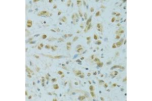 Immunohistochemistry (Paraffin-embedded Sections) (IHC (p)) image for anti-Regulator of Chromosome Condensation 1 (RCC1) (AA 1-240) antibody (ABIN6146817)