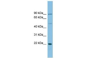 DNAJC12 antibody used at 1 ug/ml to detect target protein.