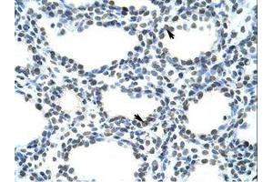 Image no. 1 for anti-Transformer 2 beta Homolog (TRA2B) (N-Term) antibody (ABIN202162) (TRA2B antibody  (N-Term))