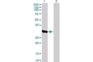 Western Blot analysis of ASB8 expression in transfected 293T cell line by ASB8 MaxPab polyclonal antibody. (ASB8 antibody  (AA 1-288))