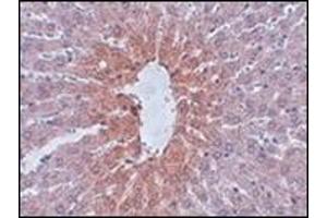 Immunohistochemistry of JMJD1C in rat liver tissue with this product at 2.