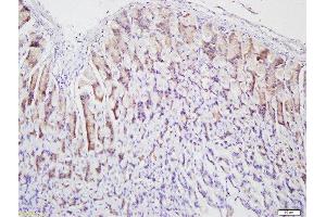 Formalin-fixed and paraffin embedded rat stomach labeled with Anti-pan Cytokeratin Polyclonal Antibody, Unconjugated  at 1:500 followed by conjugation to the secondary antibody and DAB staining. (pan Keratin antibody  (AA 331-430))
