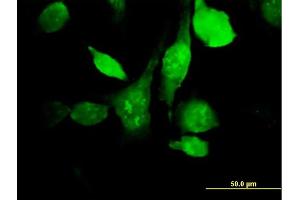 Immunofluorescence of purified MaxPab antibody to HYAL3 on HeLa cell. (HYAL3 antibody  (AA 1-417))