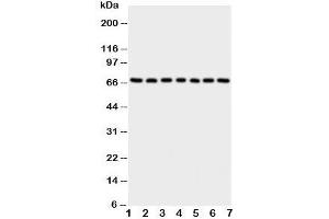 Western blot testing of NOX4 antibody and Lane 1:  rat kidney;  2: (r) heart;  3: (r) spleen;  4: human HeLa;  5: (h) 293T;  6: (h) MCF-7;  7: (h) SMMC-7721 cell lysate. (NADPH Oxidase 4 antibody  (C-Term))