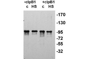 Western Blotting (WB) image for anti-ClpB2 Gene Product (CLPB2) antibody (ABIN334578) (CLPB2 antibody)