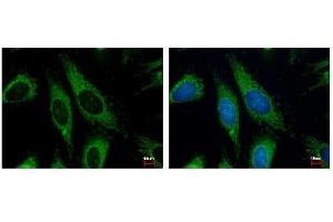 ICC/IF Image HADHA antibody detects HADHA protein at Mitochondria by immunofluorescent analysis.