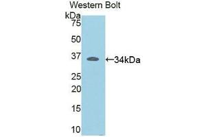 Western blot analysis of the recombinant protein. (RELB antibody  (AA 176-436))