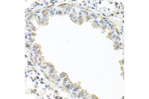 Immunohistochemistry of paraffin-embedded mouse lung using IL22 antibody (ABIN5975407) at dilution of 1/100 (40x lens).