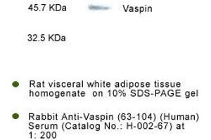 Detection of Vaspin in rat visceral fat tissue by Western Blot Kit (SERPINA12 antibody  (AA 63-104))