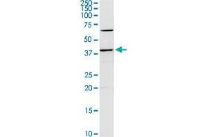 SERPINB2 MaxPab rabbit polyclonal antibody. (SERPINB2 antibody  (AA 1-415))