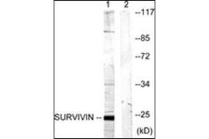 Western blot analysis of extracts from mouse lung cells, using Survivin Antibody . (Survivin antibody)