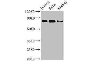 Western Blot Positive WB detected in: Jurkat whole cell lysate, Hela whole cell lysate, Mouse kidney tissue All lanes: NOA1 antibody at 3. (C4orf14 antibody  (AA 42-174))