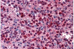 Human Spleen: Formalin-Fixed, Paraffin-Embedded (FFPE) (SIRT6 antibody  (C-Term))