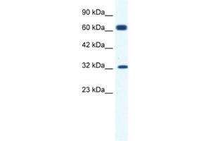 Western Blotting (WB) image for anti-Potassium Intermediate/small Conductance Calcium-Activated Channel, Subfamily N, Member 1 (KCNN1) antibody (ABIN2461099) (KCNN1 antibody)