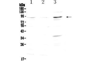 Western blot analysis of FOXP2 using anti-FOXP2 antibody . (FOXP2 antibody  (AA 637-715))
