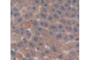 Immunohistochemistry (IHC) image for anti-Glucose-6-Phosphate Dehydrogenase (G6PD) (AA 1-515) antibody (ABIN1078069)
