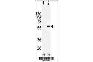 Western blot analysis of PKMYT1 using rabbit polyclonal PKMYT1 C-term using 293 cell lysates (2 ug/lane) either nontransfected (Lane 1) or transiently transfected (Lane 2) with the PKMYT1 gene. (MYT1 antibody  (C-Term))