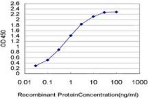 Detection limit for recombinant GST tagged IRAK4 is approximately 0. (IRAK4 antibody  (AA 1-130))