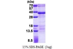 SDS-PAGE (SDS) image for Regulatory Factor X-Associated Ankyrin Containing Protein (RFXANK) (AA 1-237) protein (His tag) (ABIN6387233) (RFXANK Protein (AA 1-237) (His tag))