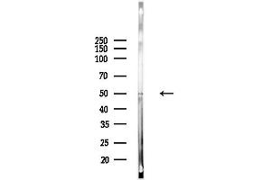 Western blot analysis of lysates from Hela cells(UV,30 min treatment), using Phospho-Smad2 (Ser467) Antibody at 1/1000 dilution.