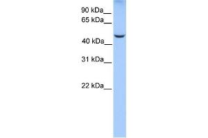 WB Suggested Anti-PHF17 Antibody Titration:  0. (PHF17 antibody  (C-Term))