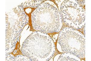 ABIN6257536 and ABIN6274704 at 1/100 staining Rat testis tissue by IHC-P.