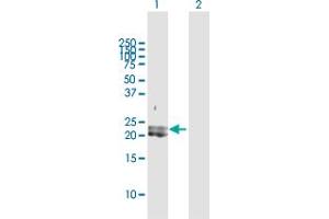 Western Blot analysis of PDGFA expression in transfected 293T cell line by PDGFA MaxPab polyclonal antibody. (PDGFA antibody  (AA 1-211))