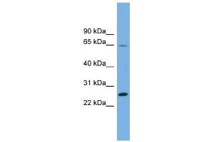 DHFRL1 antibody used at 1 ug/ml to detect target protein. (DHFRL1 antibody  (Middle Region))