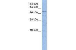 WB Suggested Anti-TRAK1 Antibody Titration: 0. (TRAK1 antibody  (Middle Region))