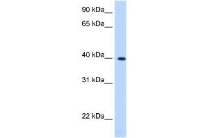 LIAS antibody used at 0. (LIAS antibody  (C-Term))