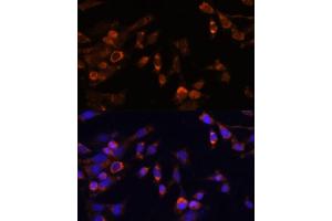 Immunofluorescence analysis of NIH-3T3 cells using PSMB7 Polyclonal Antibody (ABIN7269594) at dilution of 1:100 (40x lens). (PSMB7 antibody  (AA 44-200))