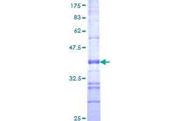RND1 Protein (AA 133-232) (GST tag)