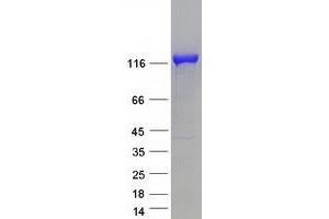 Validation with Western Blot