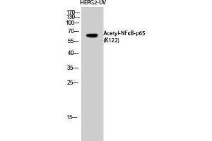 Western Blotting (WB) image for anti-Nuclear Factor-kB p65 (NFkBP65) (acLys122) antibody (ABIN3178882) (NF-kB p65 antibody  (acLys122))