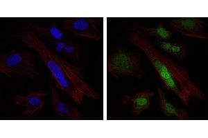 Immunofluorescence analysis of Hela cells using SOX9 mouse mAb (green). (SOX9 antibody)