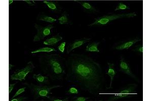 Immunofluorescence of monoclonal antibody to MAPK10 on HeLa cell. (MAPK10 antibody  (AA 1-319))