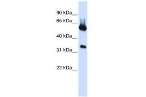 ALAS2 antibody used at 1 ug/ml to detect target protein. (ALAS2 antibody  (N-Term))