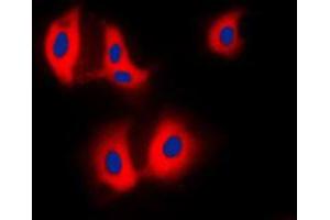Immunofluorescent analysis of ALDOA staining in HepG2 cells.