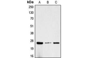 Western blot analysis of CG beta expression in MCF7 (A), SP2/0 (B), rat kidney (C) whole cell lysates. (CGB antibody  (C-Term))