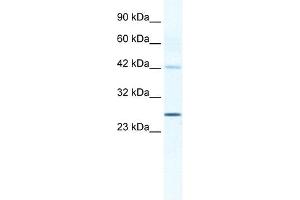 GJB4 antibody used at 1. (GJB4 antibody  (Middle Region))