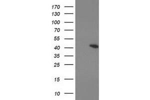 Western Blotting (WB) image for anti-Protein Kinase, CAMP-Dependent, Regulatory, Type I, beta (PRKAR1B) antibody (ABIN1500409)