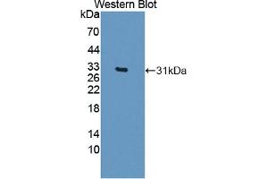 Detection of Recombinant CELSR3, Human using Polyclonal Antibody to Cadherin EGF LAG Seven Pass G-Type Receptor 3 (CELSR3) (CELSR3 antibody  (AA 1181-1421))
