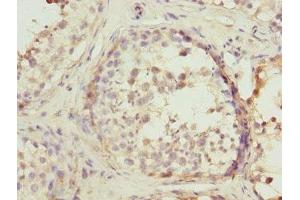 Immunohistochemistry of paraffin-embedded human testis tissue using ABIN7167503 at dilution of 1:100 (PTPRE antibody)