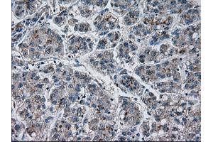 Immunohistochemical staining of paraffin-embedded Ovary tissue using anti-PRLmouse monoclonal antibody.