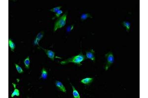 Immunofluorescent analysis of U251 cells using ABIN7159878 at dilution of 1:100 and Alexa Fluor 488-congugated AffiniPure Goat Anti-Rabbit IgG(H+L) (SLC25A18 antibody  (AA 246-287))