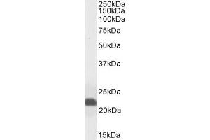Western Blotting (WB) image for anti-Caveolin 1, Caveolae Protein, 22kDa (CAV1) (Internal Region) antibody (ABIN185421)