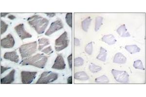 Immunohistochemistry analysis of paraffin-embedded human skeletal muscle tissue, using Bak Antibody. (BAK1 antibody  (AA 1-50))