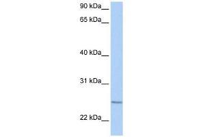 RABL4 antibody used at 1 ug/ml to detect target protein. (RABL4 antibody  (C-Term))