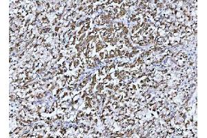 IHC analysis of GLUD1/2 using anti-GLUD1/2 antibody (ABIN7602000). (GLUD1 / GLUD2 (AA 54-553) antibody)