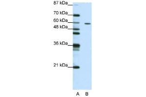 Western Blot showing ZNF382 antibody used at a concentration of 1-2 ug/ml to detect its target protein. (ZNF382 antibody  (N-Term))